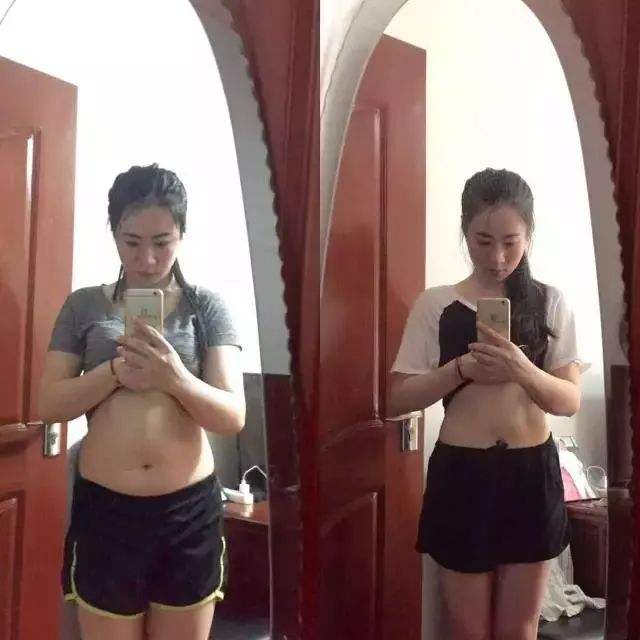 减肥溶脂线代理多少钱？