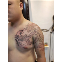 南宁黑色纹身可以洗掉吗要多少钱