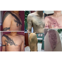 江西洗纹身哪家好