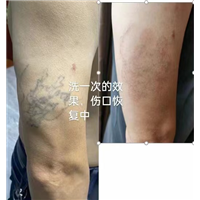 南昌纹身