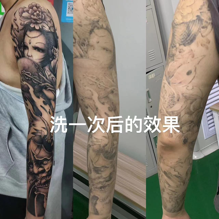 江西洗纹身哪家好