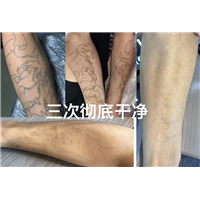 南昌纹身