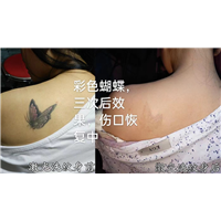 南昌刺青