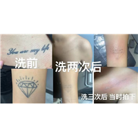 江西洗纹身哪家好