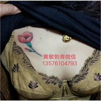 南昌洗纹身 