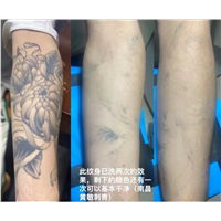 南昌洗纹身店