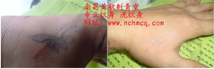 南昌洗纹身|南昌**的纹身店 