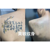江西洗纹身哪家好
