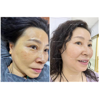 华谜祛斑效果怎么样？