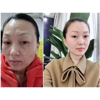 长沙祛斑哪家好