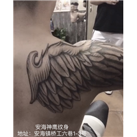 晋江激光洗纹身会不会留疤