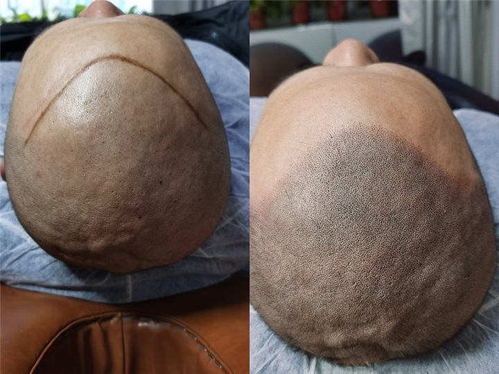 忻州纹发价格