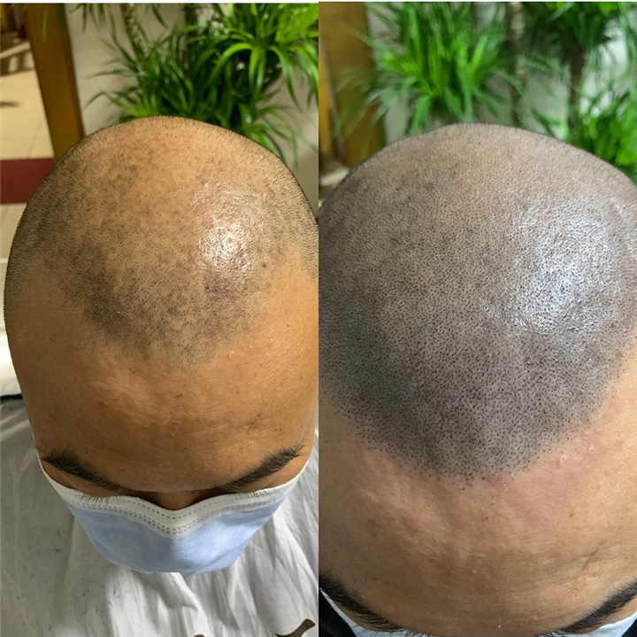 忻州纹发