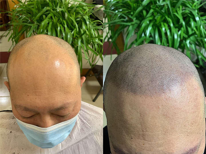 纹发价格