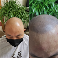忻州纹发机构山西纹发机构