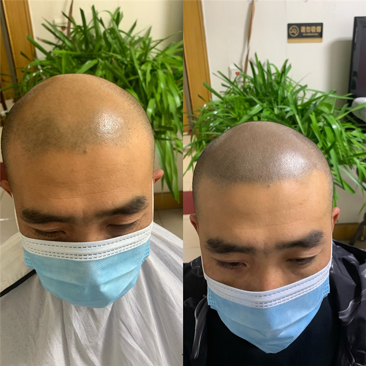 阳泉纹发哪家好