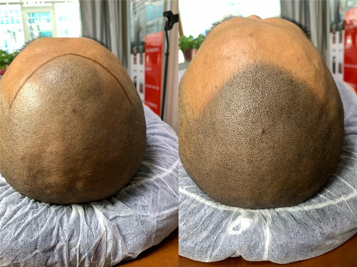 朔州纹发smp纹发