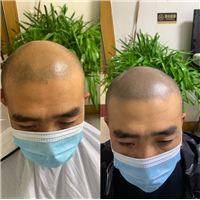 阳泉纹发哪家好