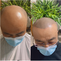 山西纹发价格
