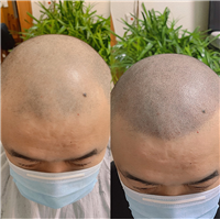 忻州纹发机构