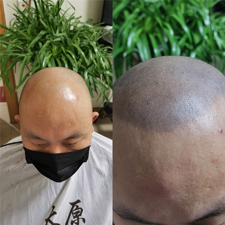 忻州纹发机构山西纹发机构