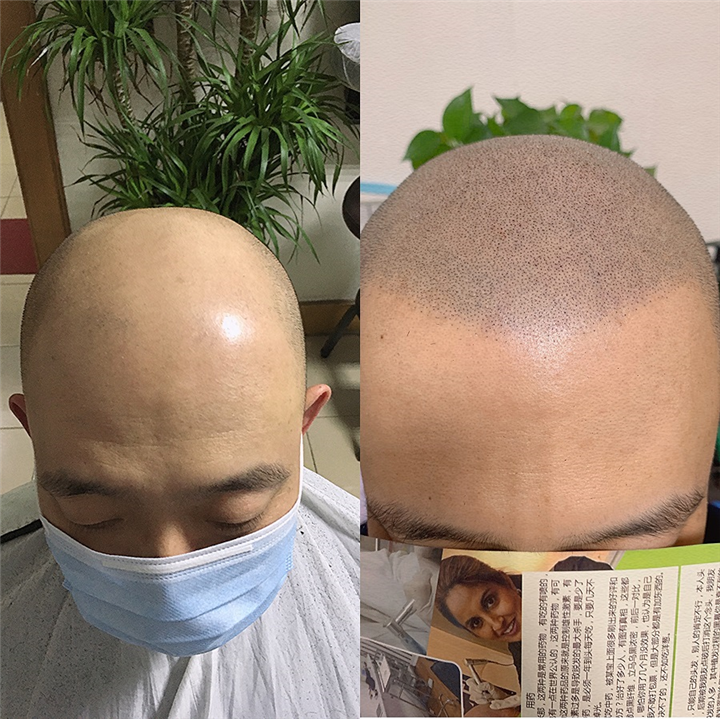 吕梁纹发