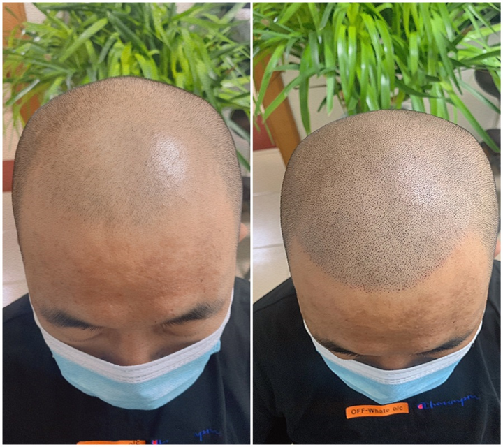朔州纹发机构纹发机构