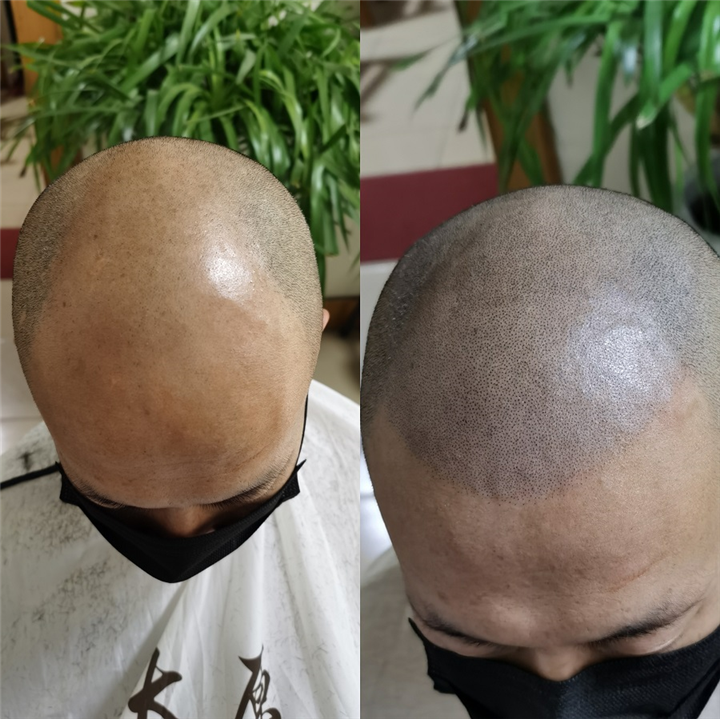 晋中纹发