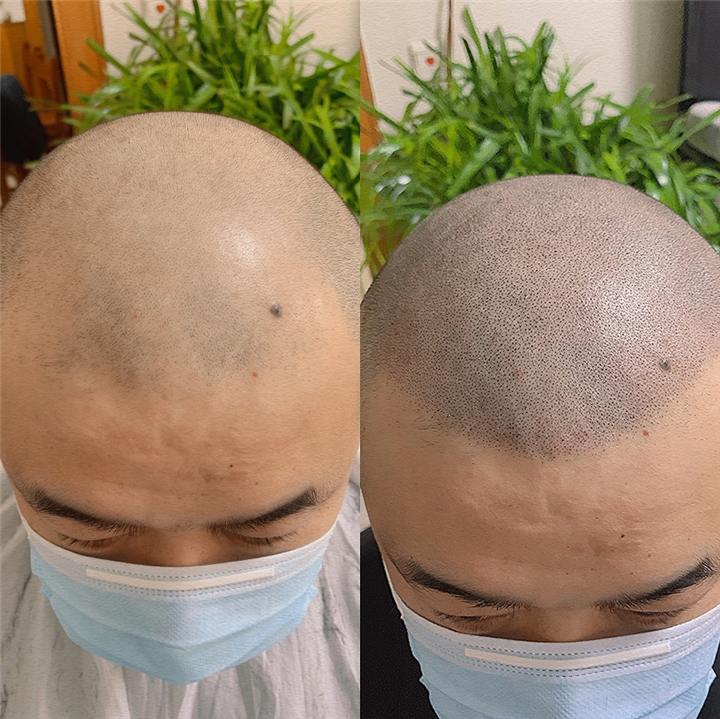 忻州纹发机构