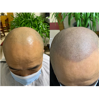 晋中纹发哪家好