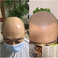 吕梁纹发