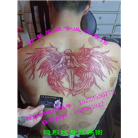 开县洗纹身咨询，开县祛斑咨询 