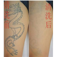 开县哪里纹身** 