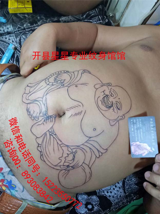 开县哪里有洗纹身 开县哪里可以取痣 