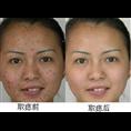 开县专业绣眉15223550772 