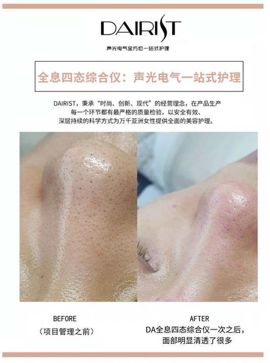 引进DA四态综合仪如何零成本拓客