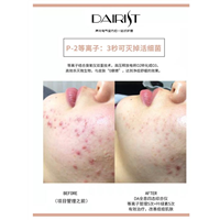 韩国Dairist点震刀代替韩国小气泡