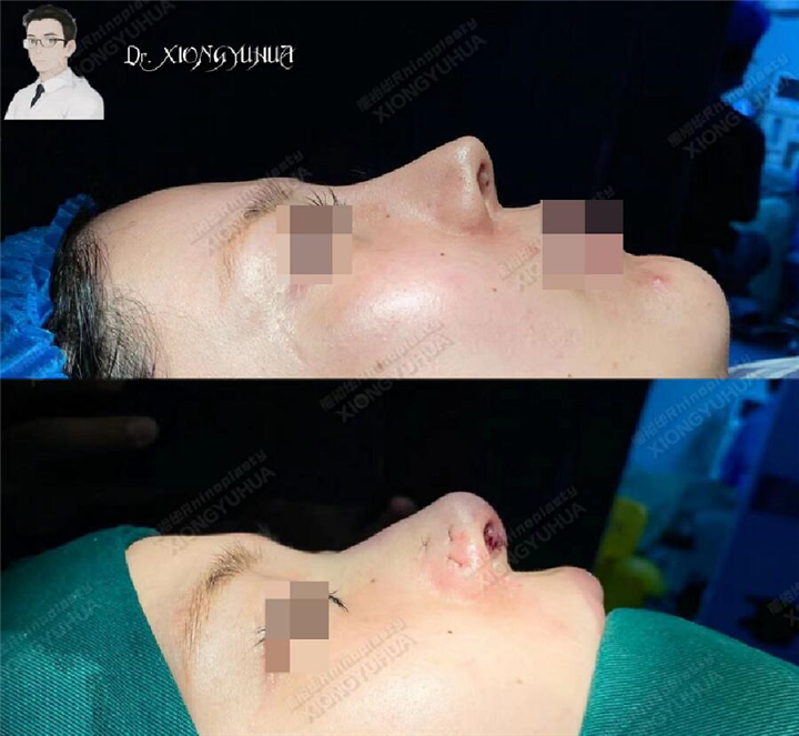 do眼睛or鼻子顺序是怎样的？