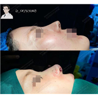 do眼睛or鼻子顺序是怎样的？