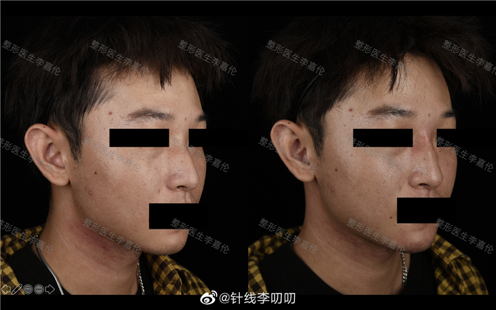整形医生李嘉伦