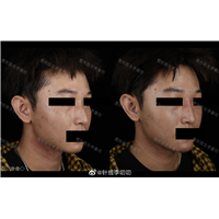 整形医生李嘉伦