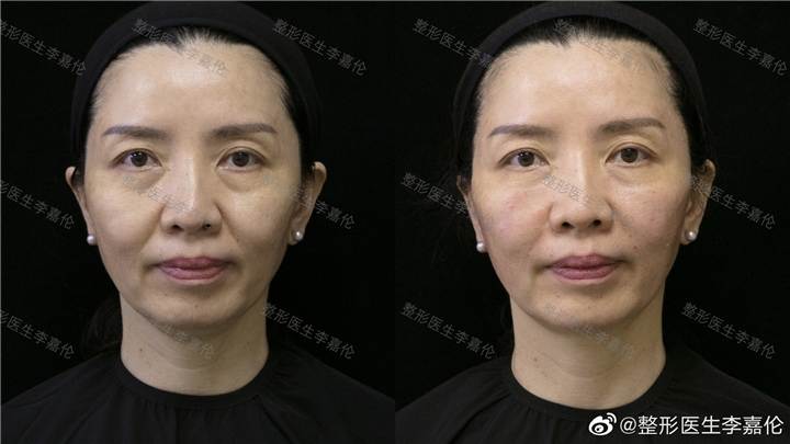 整形医生李叨叨