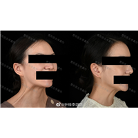 李叨叨医生