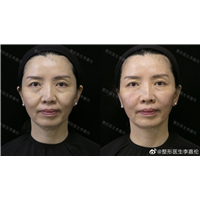 整形医生李叨叨