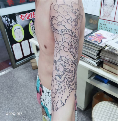 安溪遮盖疤痕多少钱