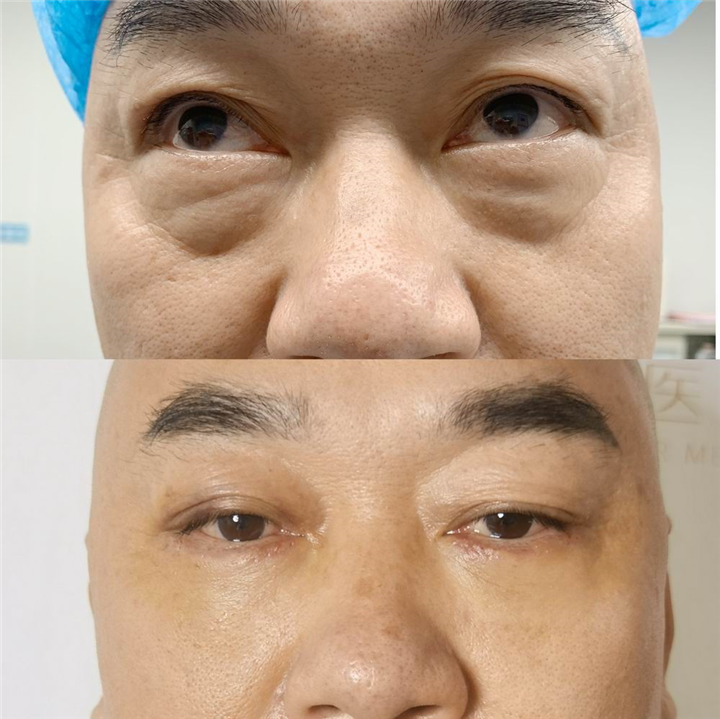 深圳整形专家苏兴