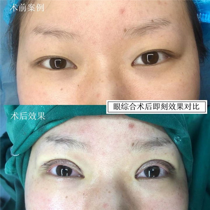苏兴整形医生