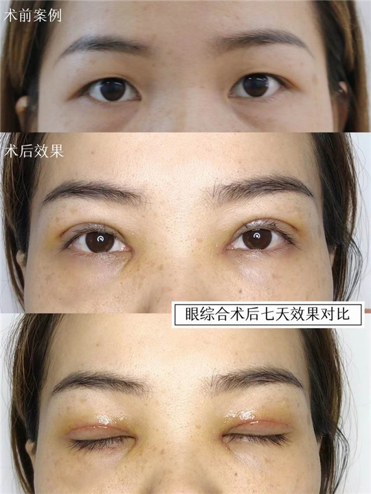 苏兴整形医生