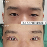 苏兴