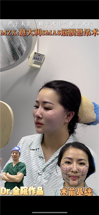 金晓东整形医生